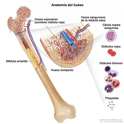 Síndrome mielodisplásico