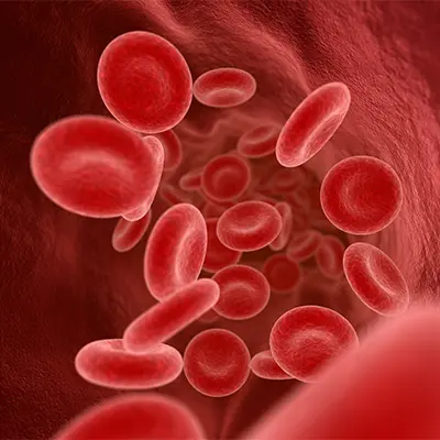 Anemia