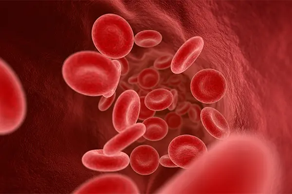 Anemia