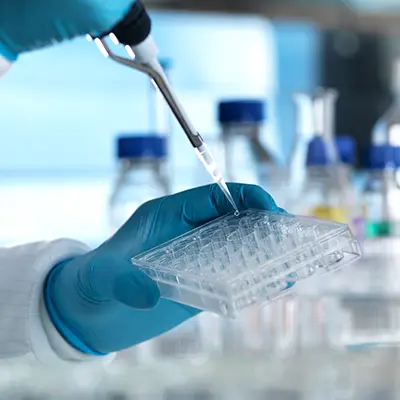 Toma de Inmunofenotipo | Cariotipo